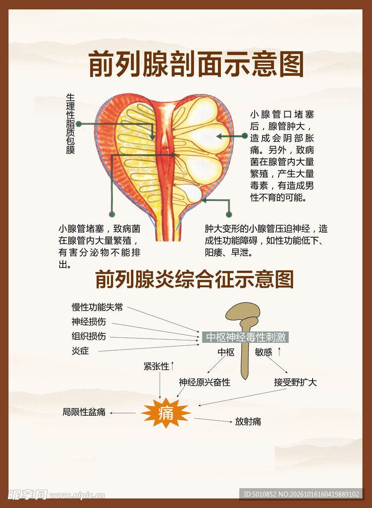  前列腺炎解刨图