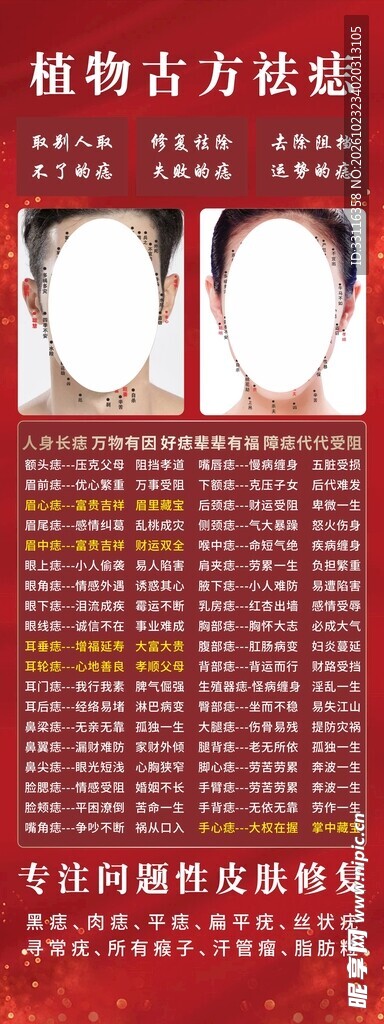 点痣