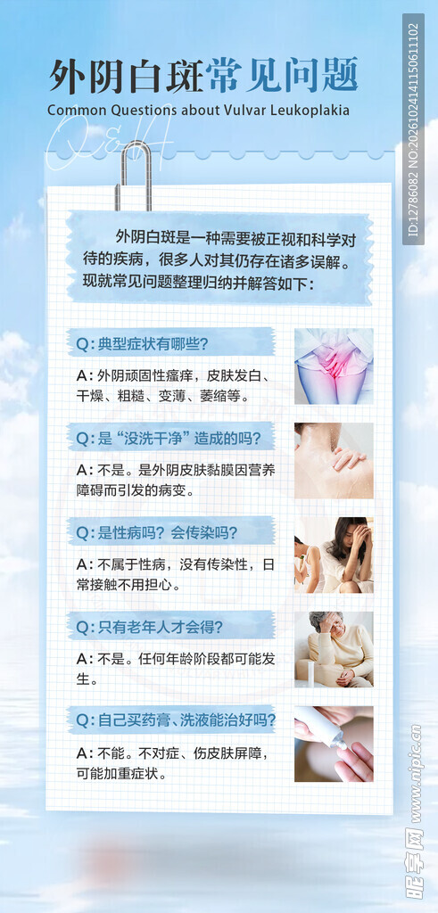 外阴白斑常见问题科普图