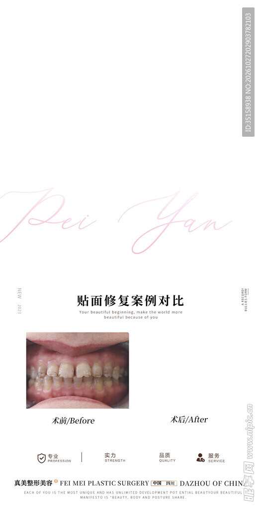 牙龈萎缩案例对比
