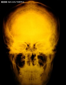 颅骨 人头骨 X光
