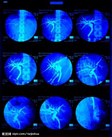 X光照片 医疗 科技卫生工作