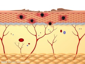 病毒入侵皮肤3D剖面图
