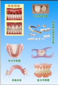 牙科宣传单海报