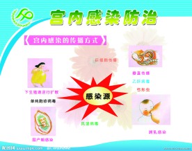 计划生育