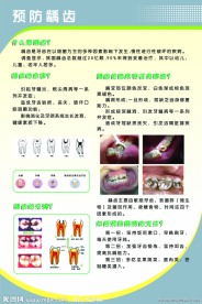 预防龋齿