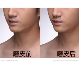 照片PS磨皮