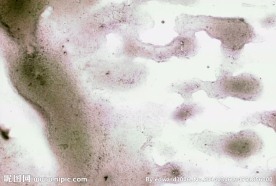 复古刮痕视频素材