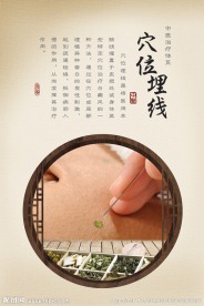中医展板穴位埋线