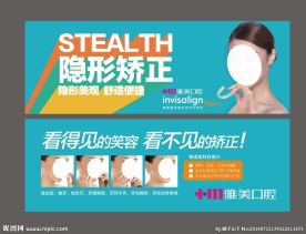 隐适美隐形矫正