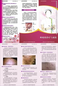 痤疮三折页