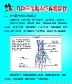 三伏贴