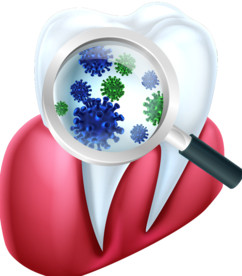 牙龈牙齿上的细菌矢量素材