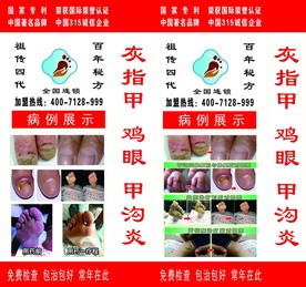 修脚海报