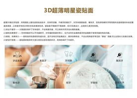 3D瓷贴面