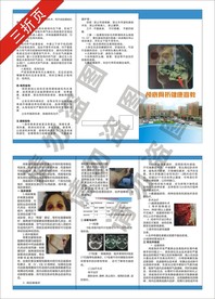 颅底骨折三折页