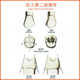 右上第二前磨牙