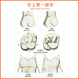 右上第一磨牙