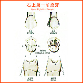 右上第一前磨牙