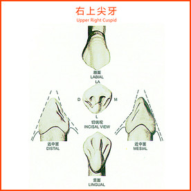 右上尖牙