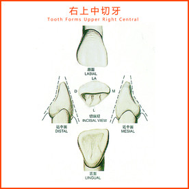 右上中切牙