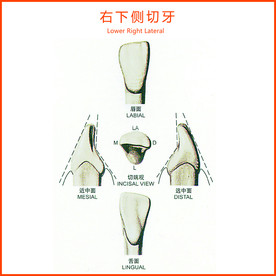 右下侧切牙