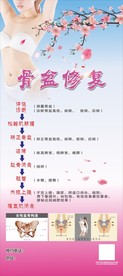骨盆修复