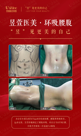 医美整形医院案例对比海报
