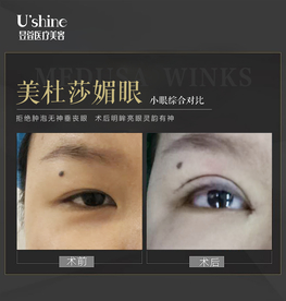 医美整形医院案例对比海报