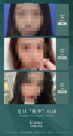 医美整形医院案例对比海报