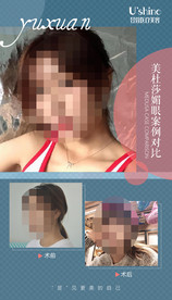医美整形医院案例对比海报