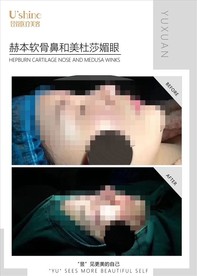 医美整形医院案例对比海报