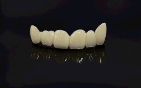 全瓷牙