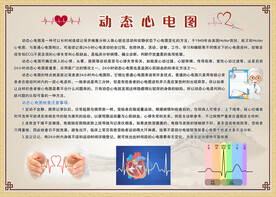 动态心电图
