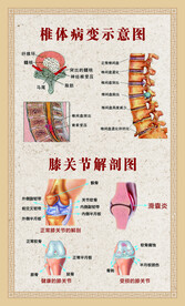 椎体病变示意图 