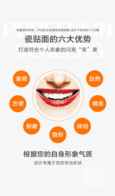 瓷贴面优势