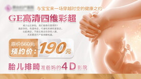 GE四维彩超