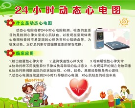 动态心电图