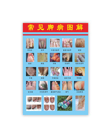 常见脚病图解图片