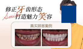 牙齿矫正