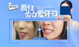 牙齿矫正