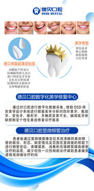 牙齿贴面