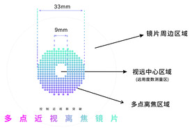 多点近视离焦镜片