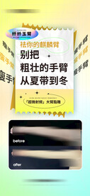 吸脂瘦身卡通医美海报