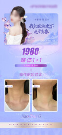 医美案例对比