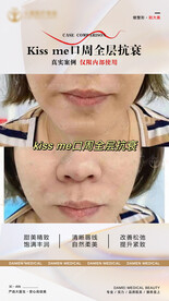 医美案例对比