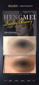 医美案例对比