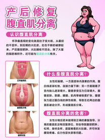 腹直肌分离