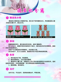 腹直肌分离