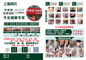 灰指甲